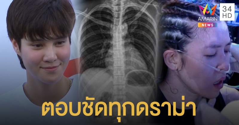 ตอบชัดทุกดราม่า! "หมอเจี๊ยบ" อัพเดตอาการซี่โครงหัก คุยกับ "เชียร์" แล้ว