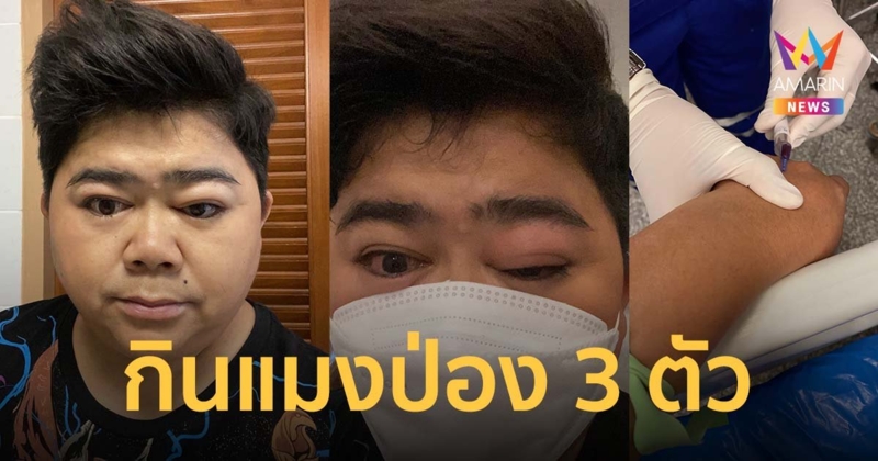 โก๊ะตี๋ อารามบอย แอดมิทด่วน หลังกินแมงป่อง 3 ตัว ต้องลั่นไม่ต้องห่วง #หนักกว่าเธอก็เจอมาแล้ว