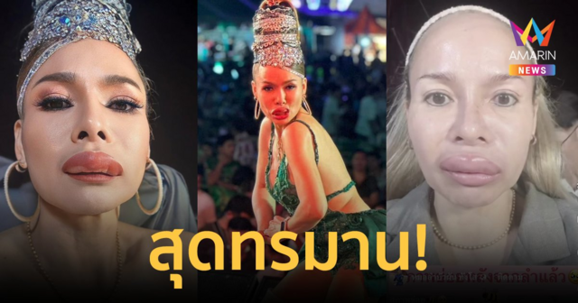 ไม่ได้ฉีด! 