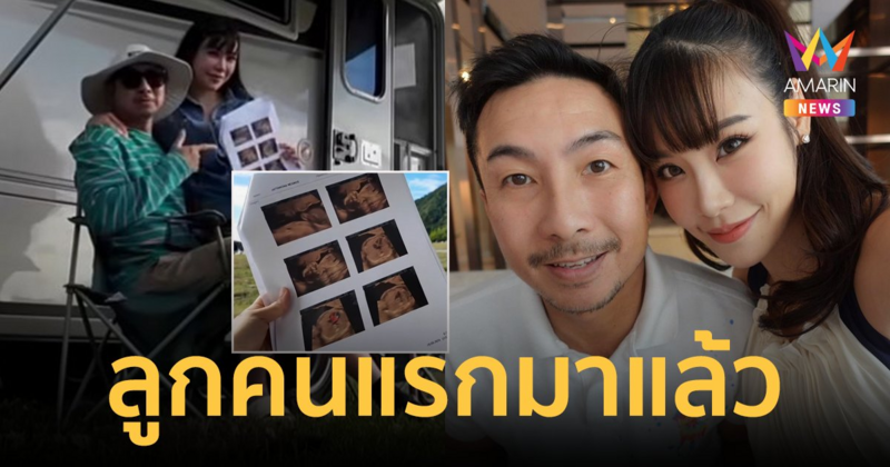 เฮลั่น! "น้องเตย" ภรรยาคนสวย "โจอี้ บอย" อวดภาพอัลตราซาวด์ ตั้งท้องลูกคนแรกแล้ว