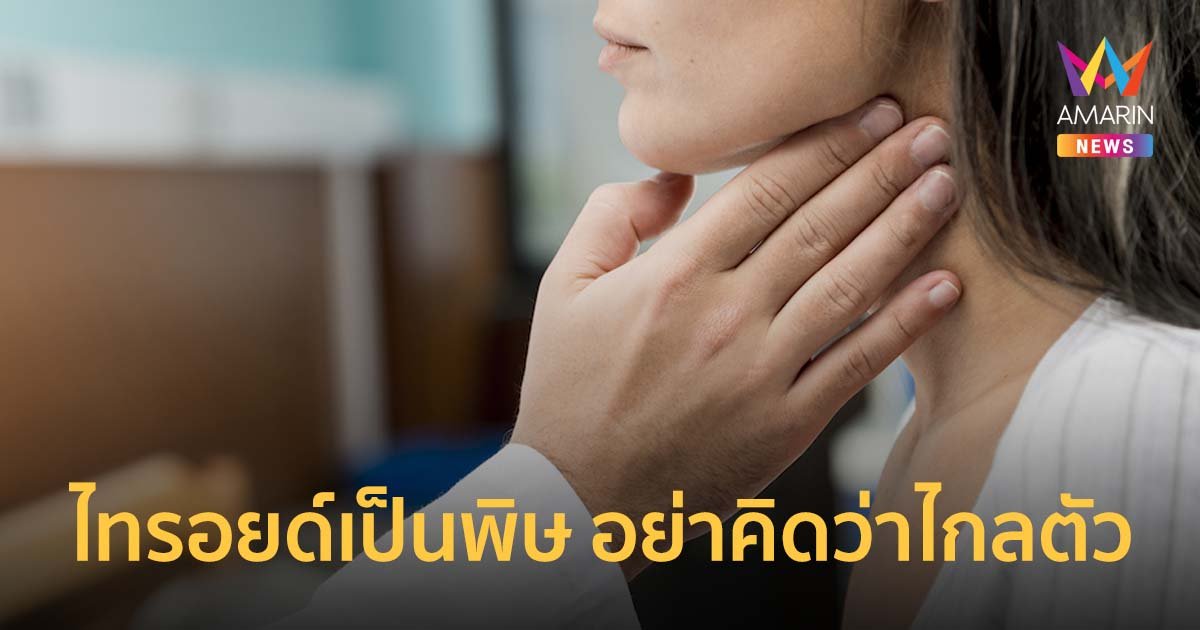 ไทรอยด์เป็นพิษ อย่าคิดว่าไกลตัว แพทย์แนะวิธีสังเกตอาการที่น่าสงสัย