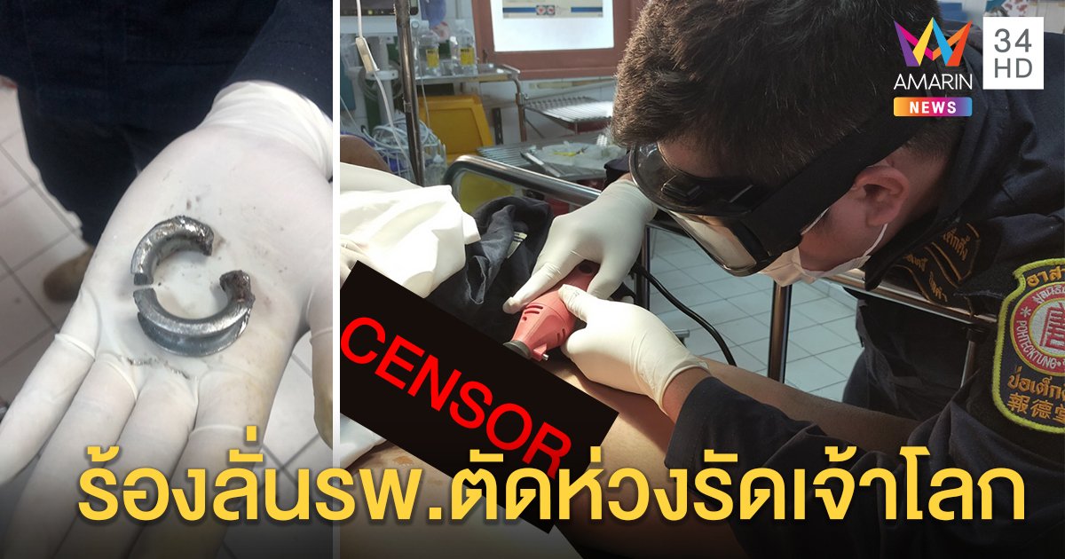 เผยนาทีสยอง ตัดห่วงรัดเจ้าโลก โจ๋สะอื้นงูน้อยระบมหวิดเน่า (คลิป)