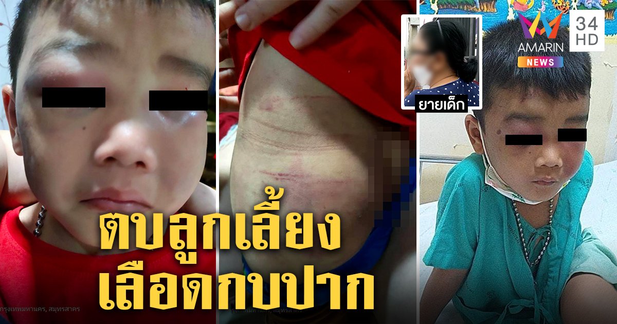 ยายเดือดหลาน 7 ขวบถูกพ่อเลี้ยงตีหน้าปูด แม่ป้องผัวใหม่ ญาติฝั่งพ่อขอเลี้ยงเอง (คลิป)