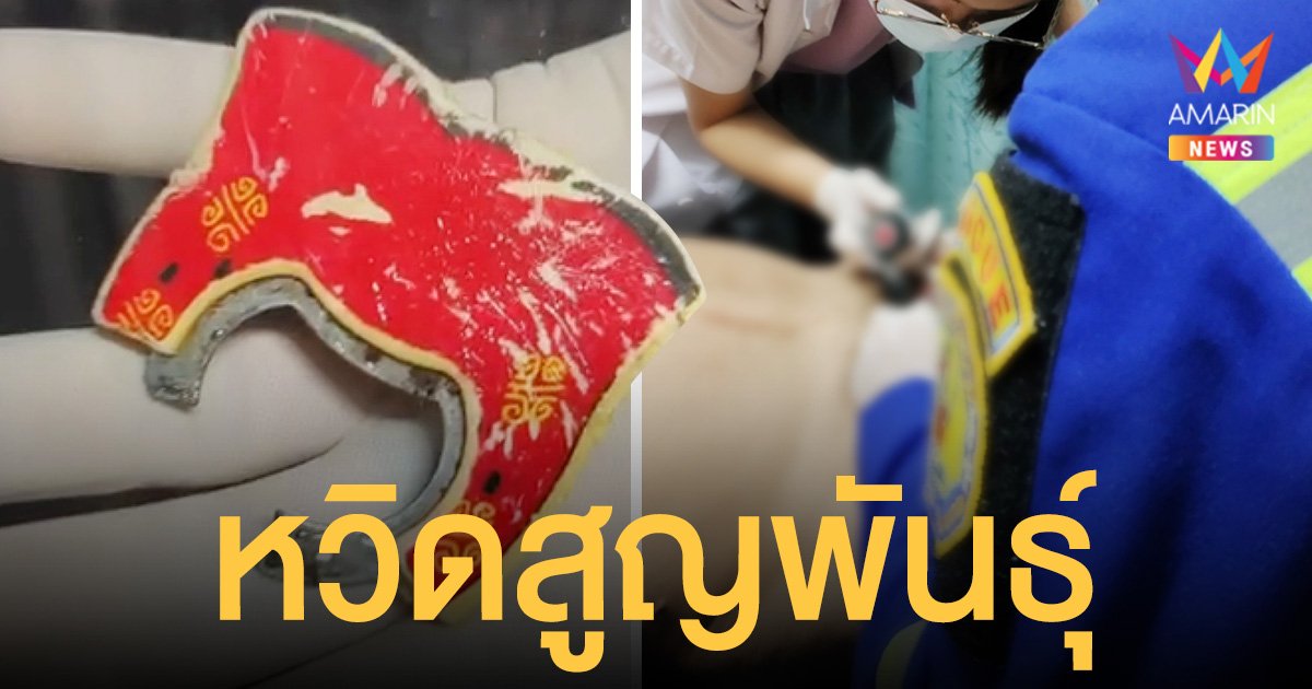 หนุ่มพิเรนทร์  ยัด "น้องชาย" ใส่ที่เปิดขวดหวังเพิ่มไซซ์อลังการ สุดท้ายเดือดร้อน หมอ-กู้ภัย