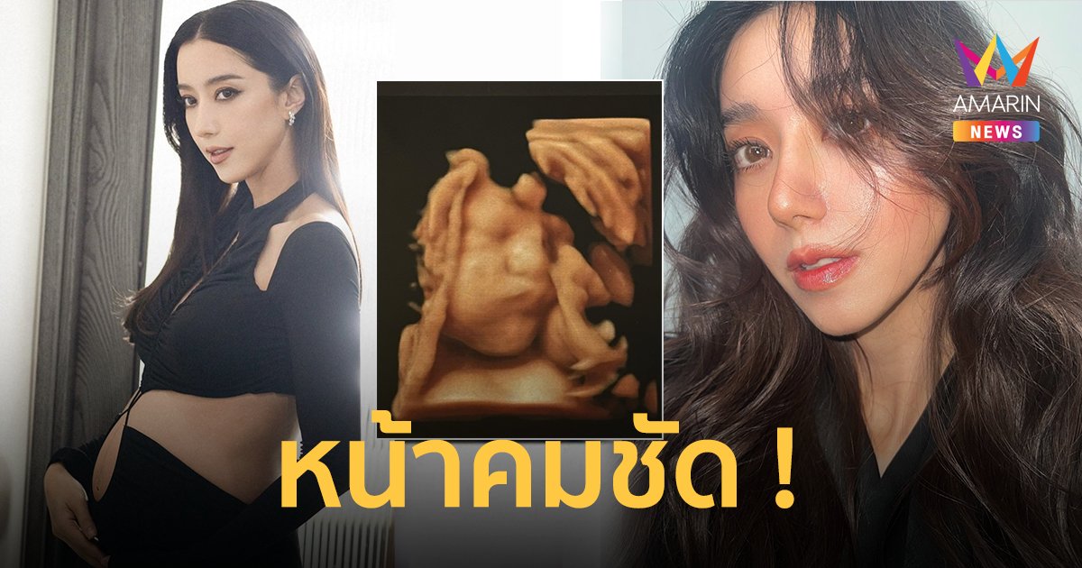"ไอซ์ อภิษฎา" อวดโฉมลูกสาว 8 เดือน ภาพอัลตราซาวด์ 4D