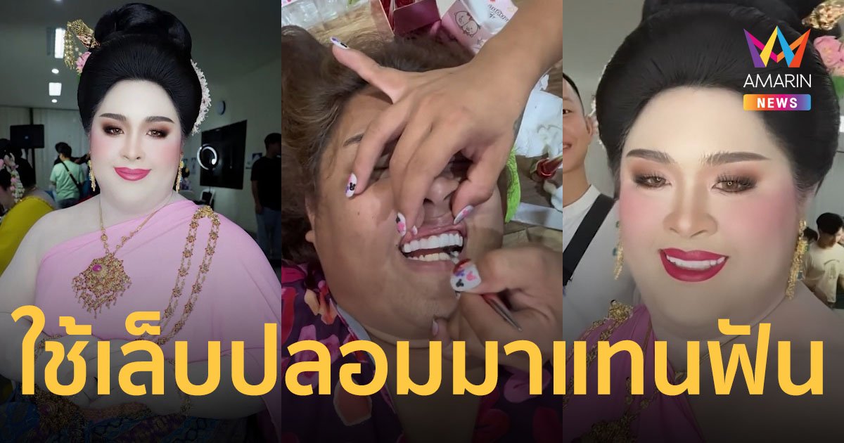 ตะลึง! ประกวดธิดาช้าง ฟันสวยแบบหลักสูตรเร่งรัด ใช้เล็บปลอมมาแปะทับ