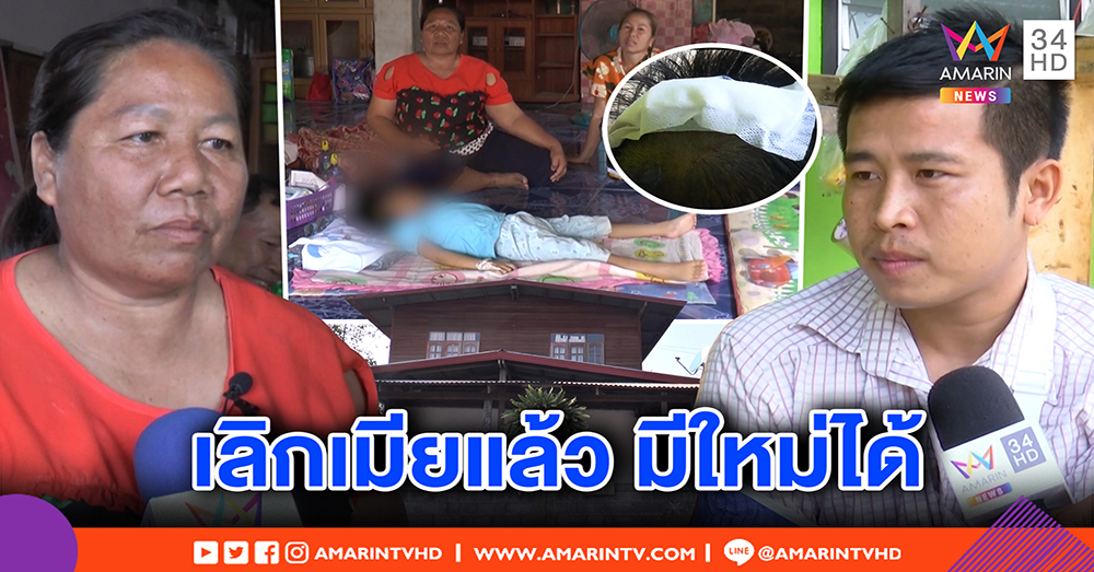 หนุ่มรักจริง ถูกพ่อแฟนดักฟันหัวไม่เอาความ โต้ทิ้งเมีย-ลูกพิการมามีใหม่ ถึงเลิกราก็ยังส่งเสีย (คลิป)