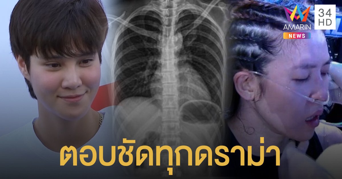 ตอบชัดทุกดราม่า! "หมอเจี๊ยบ" อัพเดตอาการซี่โครงหัก คุยกับ "เชียร์" แล้ว