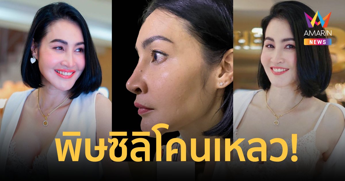 เกือบเสียโฉม! "ษา วรรณษา" เจอพิษซิลิโคนเหลว ทรมานนานนับ 10 ปี