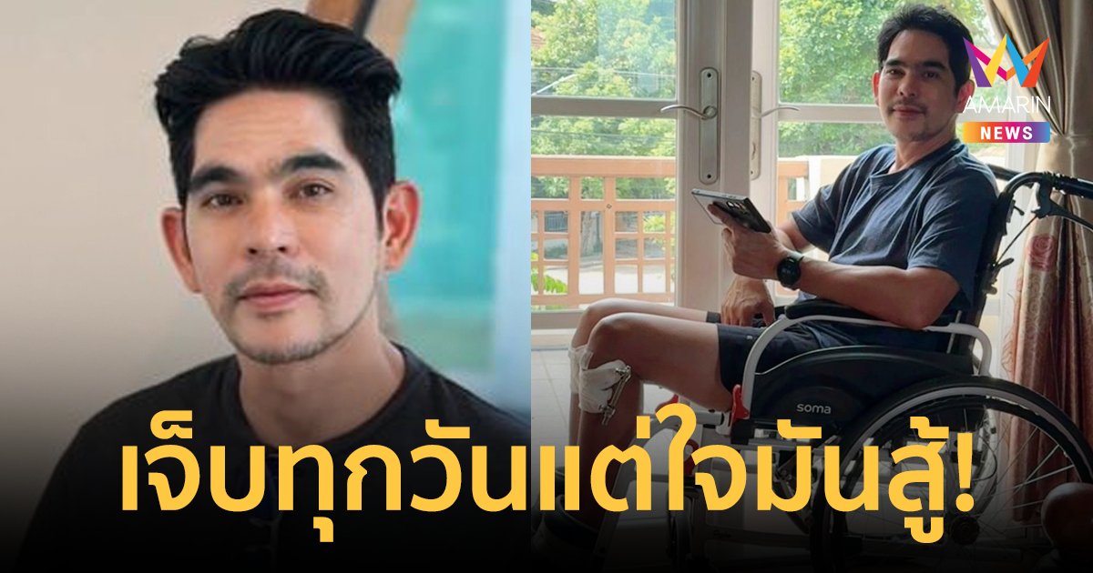เจ็บแต่ใจสู้! "บิ๊ก ศรุต" ทำกายภาพฟื้นฟูกล้ามเนื้อ หลังผ่าตัดรักษาอาการขาฉิ่ง